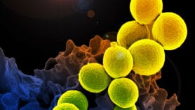 Resistencia antimicrobiana: una crisis global